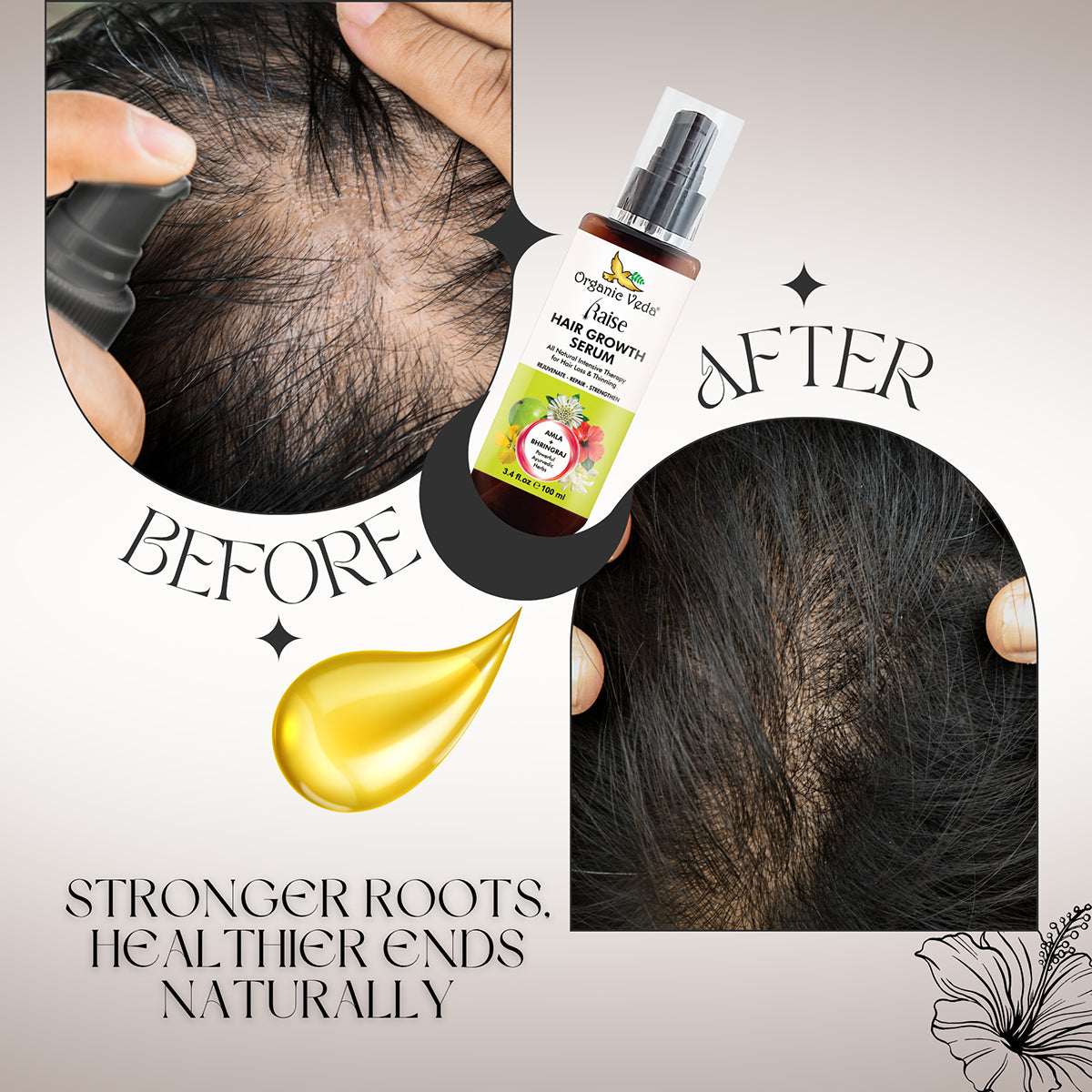 Raise Hair Growth Serum
